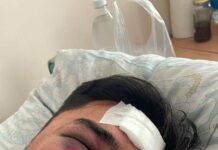 В Бишкеке избили актера, а подозреваемых отпустили. Теперь они объявлены в межгосрозыск