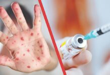 Корь в Кыргызстане: Почему вакцинация — вопрос жизни и смерти