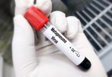 Кыргызстанда метапневмовирустун канча учуру катталгандыгы айтылды