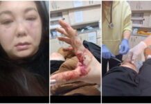 Кыргызстанку жестоко избил и забрал ребенка супруг — гражданин Турции