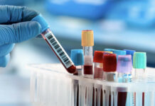 ГКНБ предлагает проводить в своей лаборатории платные ДНК-анализы