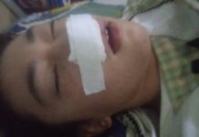 В ноокатской школе ученицу избили и сломали нос. Милиция закрыла дело