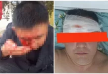 В Сокулуке избили блогера и активиста Мирбека Манаясова