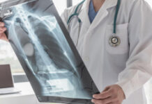 В одной из школ Иссык-Кульской области у 15 детей обнаружили туберкулез