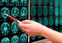 В Бишкеке впервые официально и успешно проведён тромболизис при инсульте. Об этом сообщили в Нацгоспитале.