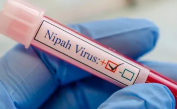 Нипах вирусунун алдын алуу: Чек арада көзөмөл күчөтүлдү