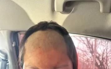 В Джалал-Абаде 16-летней девушке насильно сбрили волосы и брови, после чего избили