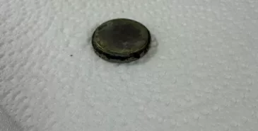 В Бишкеке полуторагодовалая девочка проглотила батарейку, врачи ее спасли Главная