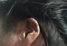 В Таласе мужчина облил бензином жену и поджег, сообщили в УВД