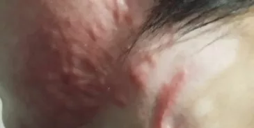 В Таласе мужчина облил бензином жену и поджег, сообщили в УВД Главная